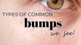 Types of common bumps we see