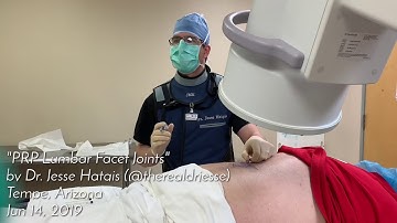 How to Perform PRP Injections for Lumbar Facet Joint Pain