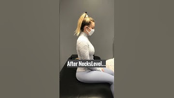After a neck fracture...