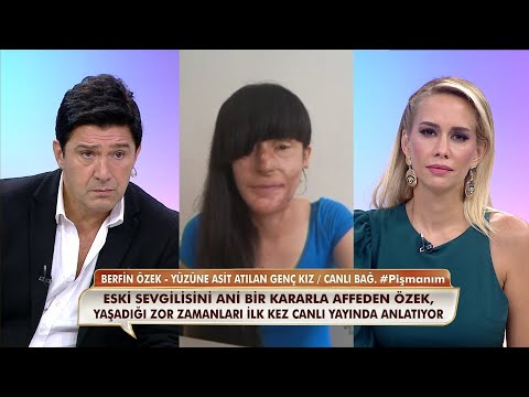Yüzüne asit döken
