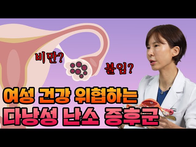 내 비만의 원인, 다낭성 난소 증후군?