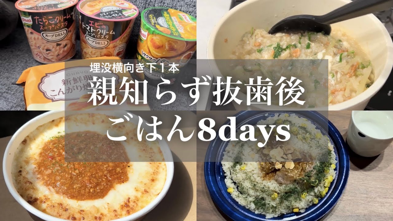 親知らず抜歯後の食事8days🍚,埋没横向き下側親知らず1本抜歯🦷