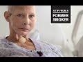 CDC: Tips From Former Smokers