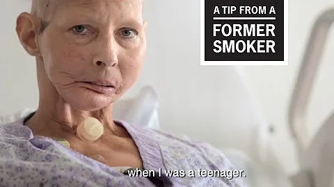 CDC: Tips From Former Smokers - Terrie H.: Teenager Ad - DayDayNews