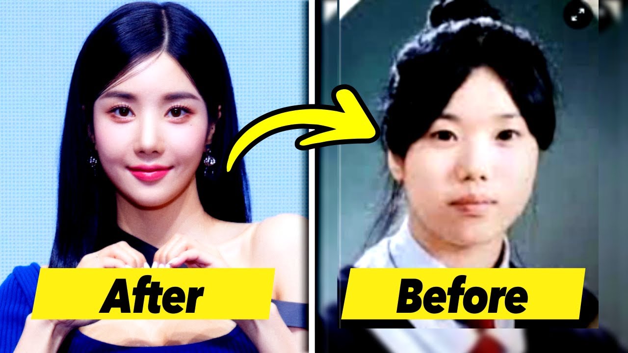 K-netizens React to Kwon Eun Bi’s Appearance Before Plastic Surgery - 