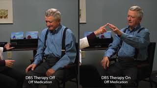 Medtronics Deep Brain Stimulation Patient