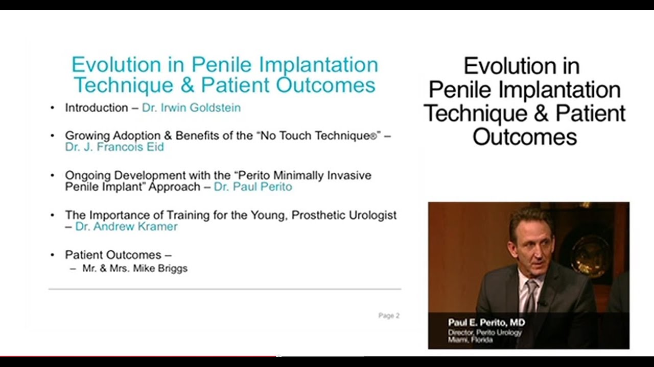 Evolution in Penile Implantation Technique and Patient Outcomes