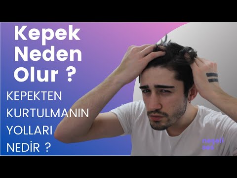 Kepek Nedir ? | Kepek Neden Oluşur ? | Kepekten Kurtulmanın Yolları Nedir ?