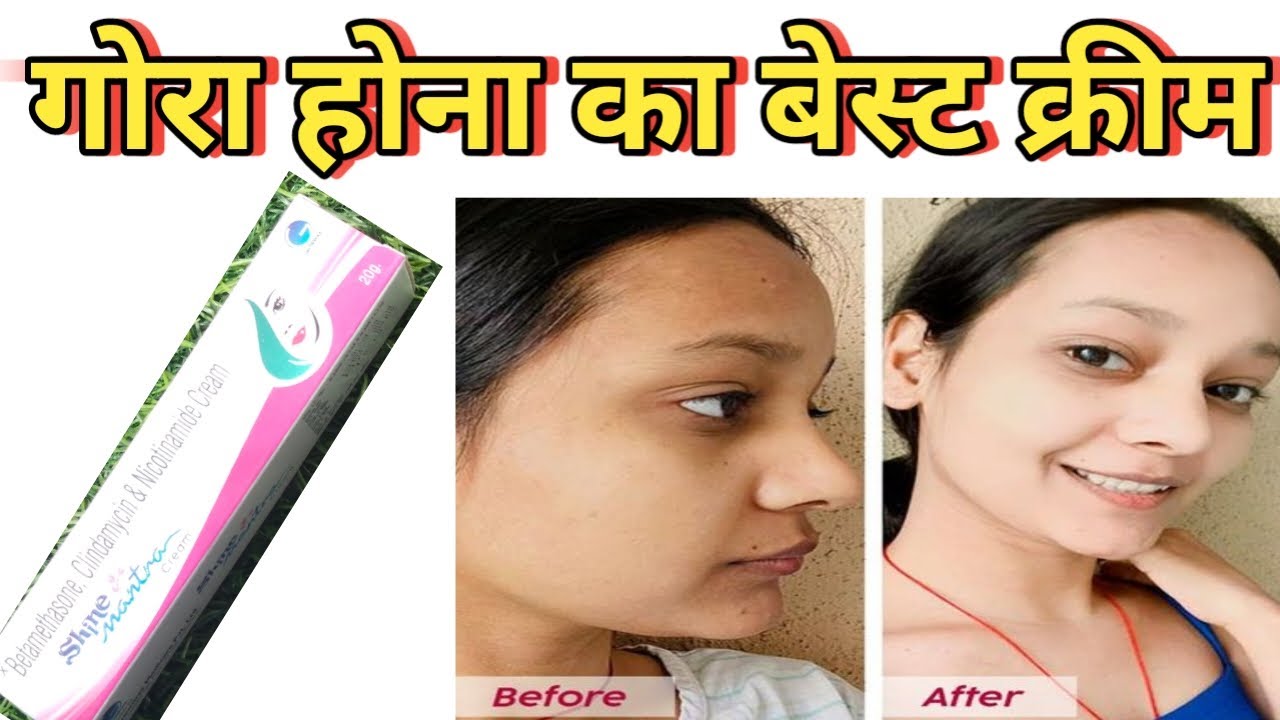 Shine Mantra Skin glow cream// गौरा होने की बेस्ट क्रीम// best skin clear cream// clindamycin cream
