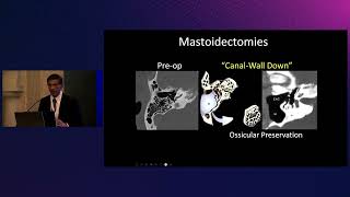 Surgical approaches and postoperative temporal bone imaging | Prof. Suresh K. Mukherji