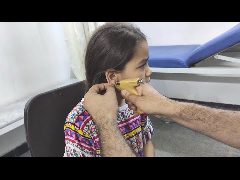 فيديو: كيفية ثقب آذان الطفل