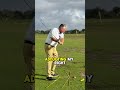 Fix Your Over the top In 30 Seconds !!