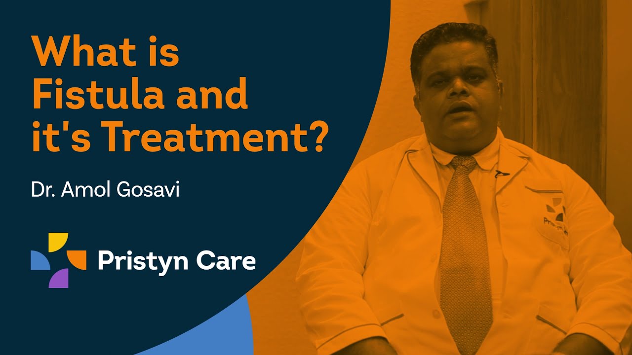 Best Fistula Laser Surgery | 0806-5417-722