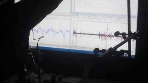 Visual Cortex Strobe Response