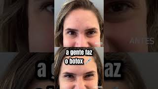 Qual a diferença entre Botox e Preenchimento? Qual a diferença entre Botox e Preenchimento?