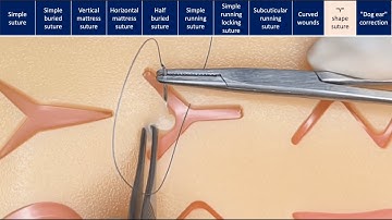 Suturing techniques