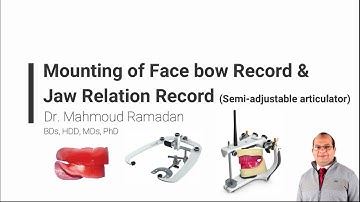 23- Facebow mounting (transfer) on a semi-adjustable articulator