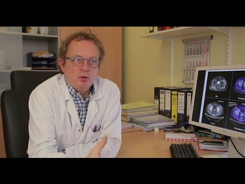 Vidéo: PCA3 Dans Le Dépistage Du Cancer De La Prostate Et De L'agressivité Tumorale Chez 407 Patients à Haut Risque: Une Expérience Du National Cancer Institute