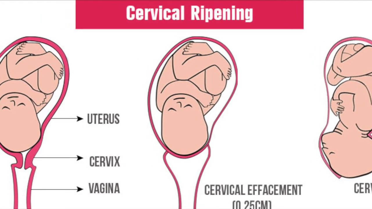 Normal Vaginal Delivery Explained In English Youtube