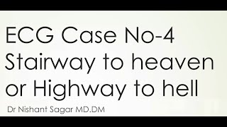 Case no 4-Stairway to heaven or highway to hell