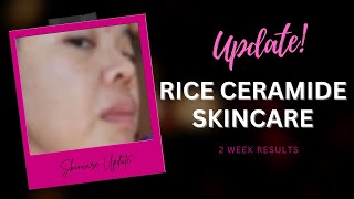 The Face Shop Rice Ceramide Moisturizing Skincare (2 week results)