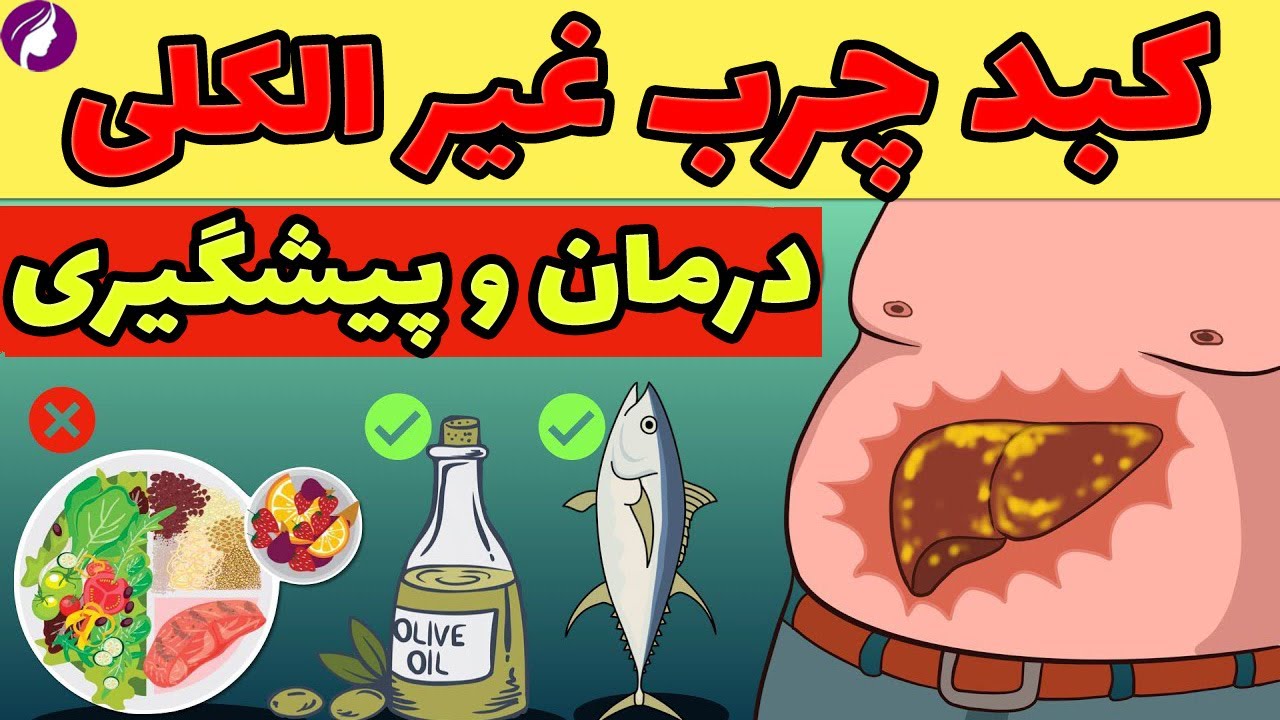 درمان کبد چرب غیر الکلی ❌ چرا کبد انسان چرب می شود؟ 😢 پیشگیری از کبدچرب