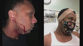 Portland man sues city, alleges PPB officer attacked him