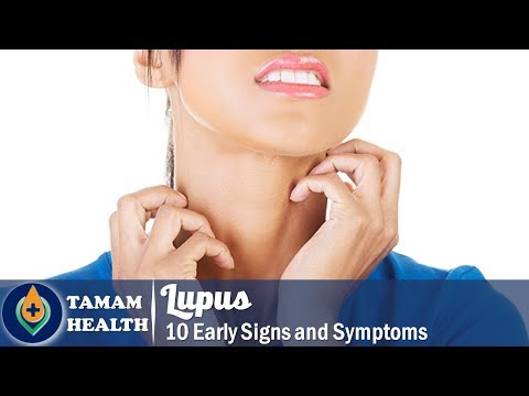 10 Early Signs of Lupus