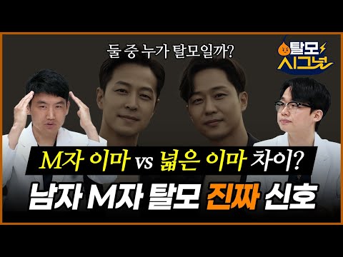 "이마 넓으면 나도 탈모?!" 전문의가 알려주는 '진짜' M자 탈모 자가진단법 [탈모시그널 Ep.2]