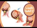 نزيف المخ وأسبابها وتشخيص النزيف مع د محمد فؤاد أستاذ جراحة المخ والاعصاب