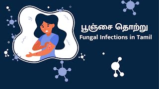 Ringworm | பூஞ்சை தொற்று | Fungal Infections in Tamil