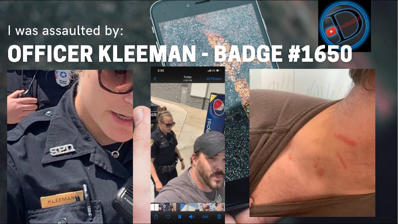 Assaulted by Officer Kleeman Badge 