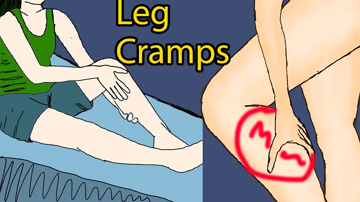 Night leg cramps - Leg Cramps at Night: Causes, Pain Relief & Prevention - DayDayNews