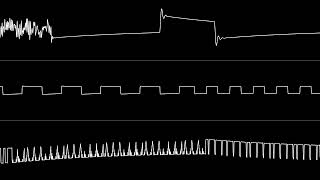 Celebrity C64 Original: Trapped in a Box (8580 SID) Profile