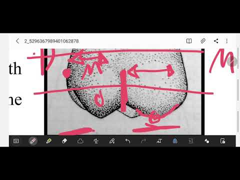    1  تشريح الاسنان الضرس الاول العلوي