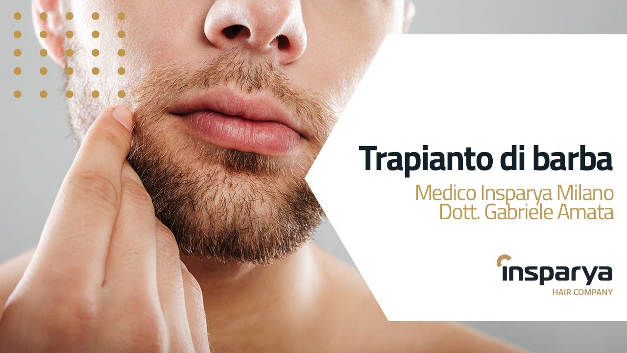 Trapianto di Barba