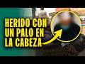 Golpean brutalmente a adulto mayor: Comerciante queda gravemente herido tras negarse a pagar cupos