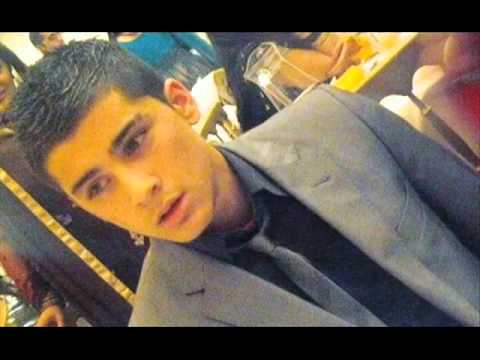 face slimming surgery before and after zayn malik