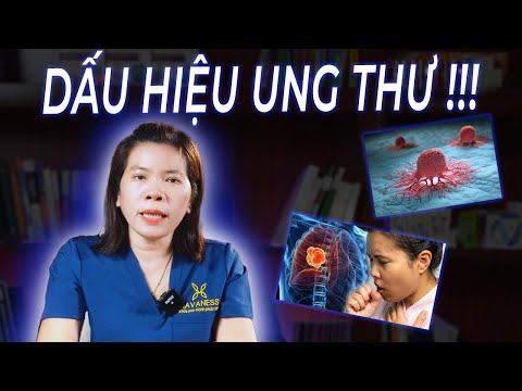 4 dấu hiệu
