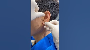 Xỏ khuyên vị trí thịt tai tại Sài Gòn #piercing #tinybox #lamdep #piercings