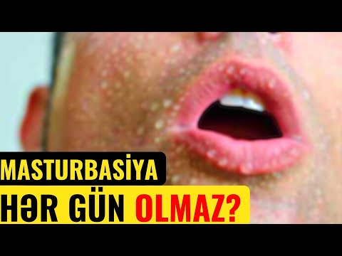 Video: Həddindən artıq qoruyucu oğlan nə deməkdir?