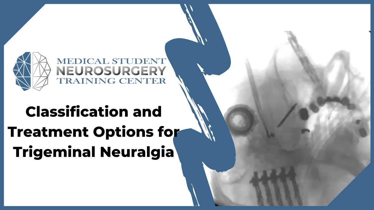 Classification And Treatment Options For Trigeminal Neuralgia YouTube Classification and treatment options for trigeminal neuralgia youtube