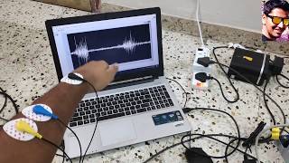 Standard EMG data acquisition (Single channel)