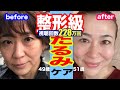 【永久保存版】１週間で激変！目の下のたるみをとるマッサージ＆エクササイズ夜の7分ルーティン