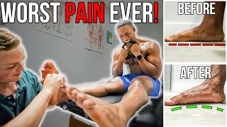 The WORST PAIN EVER! | Fixing 30 YEARS Of Flat Feet! (MUST DO!)