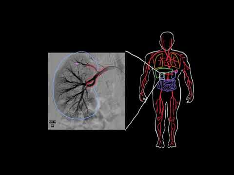 Video: Pan tıbbi terimlerle ne anlama geliyor?