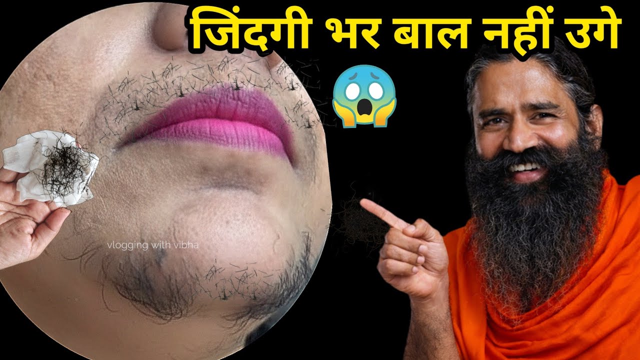 डॉक्टर ने बताया Vaseline से बिना दर्द चेहरे के बाल निकालने का आसान तरीका😱|| Facial Hair Removal