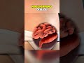 Hirschsprung disease |3D ANIMATIONS| #HirschsprungDisease #CongenitalDisorder #fyp