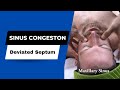 Sinus congestion sinus adjustment helped by dr suh at specific chiropractic nyc