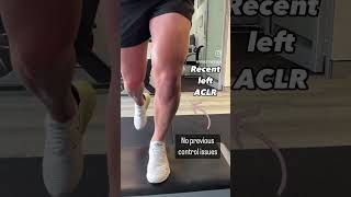 Snapshot progress of return to sport stage for 2 x ACLR